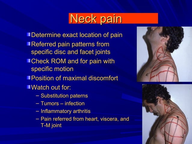Cervical radiculopathy 1st mech diag 2008 | PPT