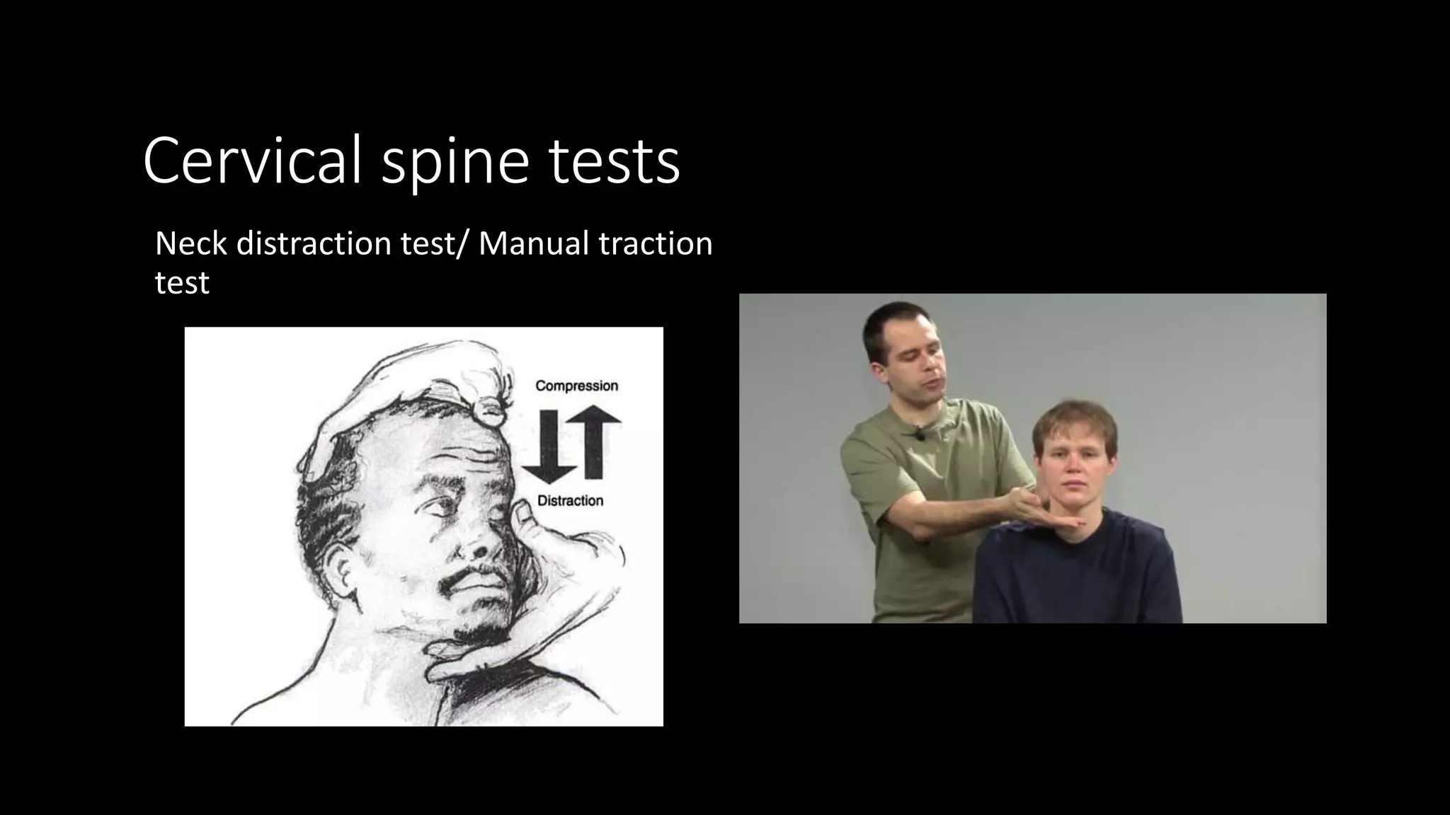 Cervical radiculopathy | PPSX