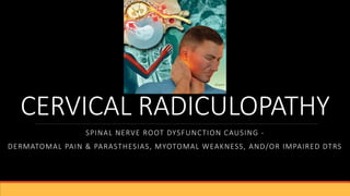 CERVICAL RADICULOPATHY
SPINAL NERVE ROOT DYSFUNCTION CAUSING -
DERMATOMAL PAIN & PARASTHESIAS, MYOTOMAL WEAKNESS, AND/OR IMPAIRED DTRS
 