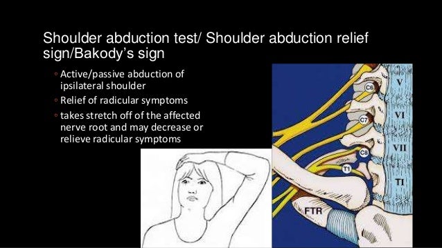 test for lumbar radiculopathy test for lumbar radiculopathy
