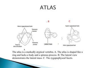 The atlas is a markedly atypical vertebra. A. The atlas is shaped like a
ring and lacks a body and a spinous process. B. The lateral view
demonstrates the lateral mass. C. The zygapophyseal facets.
. B C
 