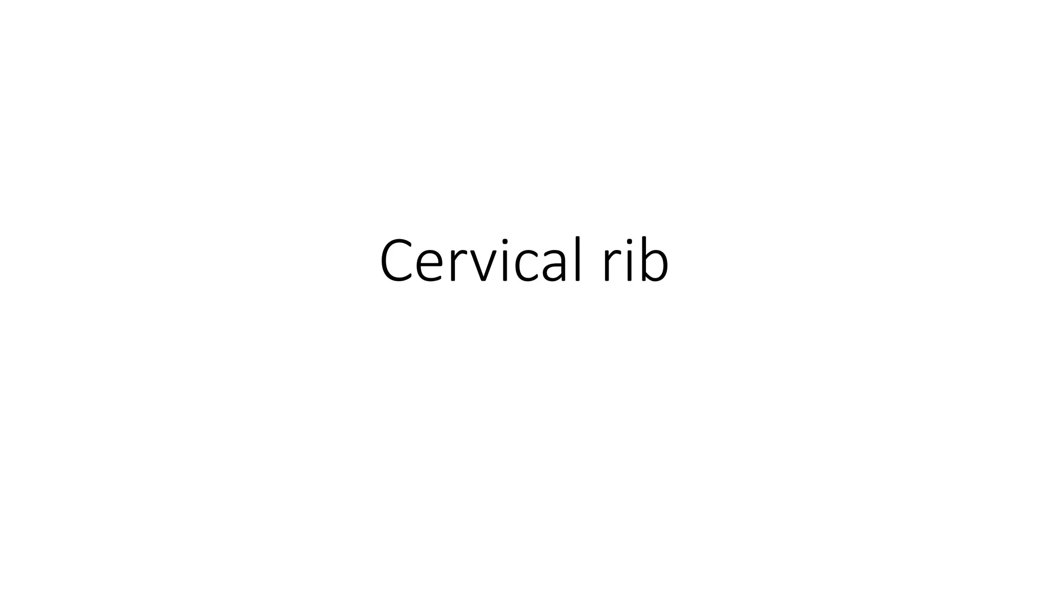 Cervical rib | PPTX