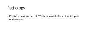 Pathology
• Persistent ossification of C7 lateral costal element which gets
reabsorbed.