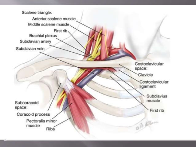 Cervical rib syndrome | PPTX | Death, Injury, or Military Conflict ...