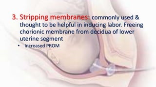 3. Stripping membranes: commonly used &
thought to be helpful in inducing labor. Freeing
chorionic membrane from decidua of lower
uterine segment
• Increased PROM
 