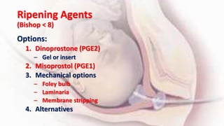 Ripening Agents
(Bishop < 8)
Options:
1. Dinoprostone (PGE2)
– Gel or insert
2. Misoprostol (PGE1)
3. Mechanical options
– Foley bulb
– Laminaria
– Membrane stripping
4. Alternatives
 