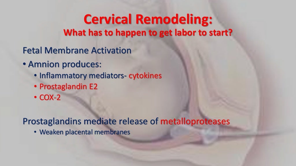 Cervical Ripening cervical-ripening