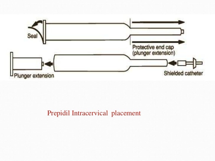Cervical ripening and labour induction Cervical ripening and labour induction