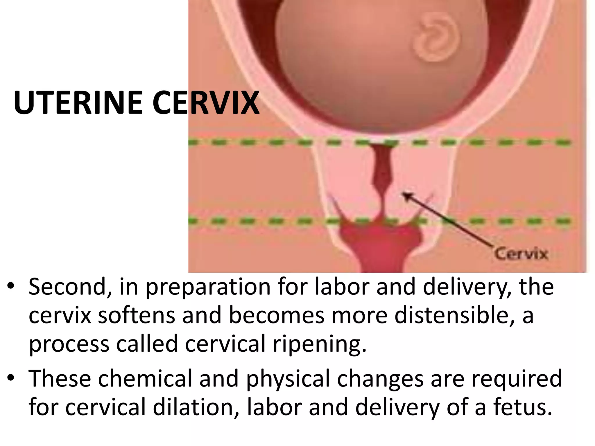 Cervical Ripe Cervical ripening and the bishop score | PPTX
