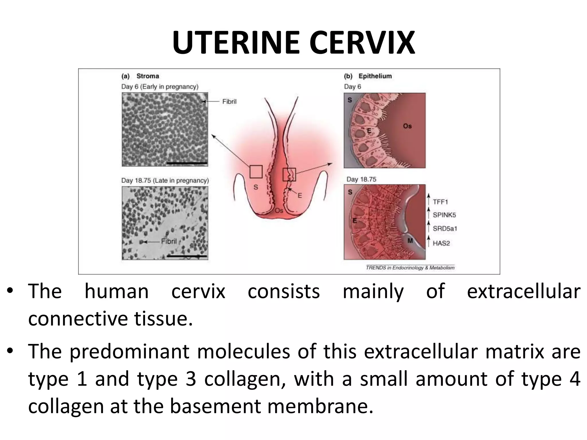 Cervical Ripe Cervical ripening and the bishop score | PPTX