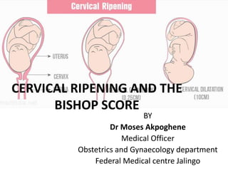 CERVICAL RIPENING AND THE
BISHOP SCORE
BY
Dr Moses Akpoghene
Medical Officer
Obstetrics and Gynaecology department
Federal Medical centre Jalingo
 