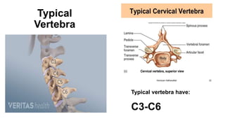Typical
Vertebra
Typical vertebra have:
C3-C6
 