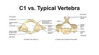 C1 vs. Typical Vertebra
 