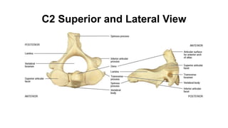 C2 Superior and Lateral View
 