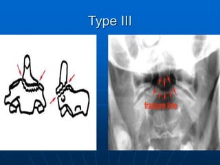 Imaging of the Cervical Spine Injuries.ppt