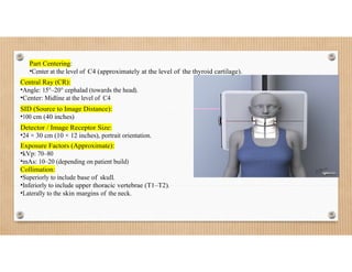 cervical spine.docx Cervical Spine Imaging Techniques | DOCX