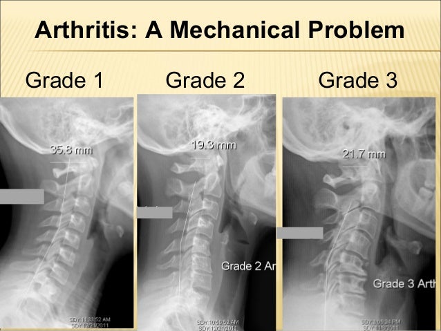 Cervical spine and shoulder problems