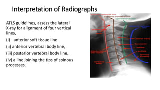 Interpretation of Radiographs
ATLS guidelines, assess the lateral
X-ray for alignment of four vertical
lines,
(i) anterior soft tissue line
(ii) anterior vertebral body line,
(iii) posterior vertebral body line,
(iv) a line joining the tips of spinous
processes.
 
