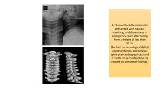 A 12-month-old female infant
presented with nausea,
vomiting, and drowsiness to
emergency room after falling
from a height of less than
30 cm.
She had no neurological deficit
at presentation, and cervical
spine plain radiographs (a) and
CT with 3D reconstruction (b)
showed no abnormal findings.
 