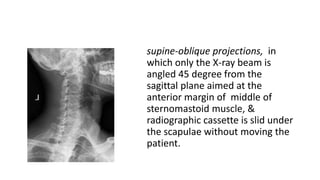 supine-oblique projections, in
which only the X-ray beam is
angled 45 degree from the
sagittal plane aimed at the
anterior margin of middle of
sternomastoid muscle, &
radiographic cassette is slid under
the scapulae without moving the
patient.
 