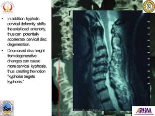 • In addition,kyphotic
cervicaldeformity shifts
theaxial load anteriorly,
thuscan potentially
accelerate cervicaldisc
degeneration.
• Decreased disc height
fromdegenerative
changescan cause
morecervical kyphosis,
thus creatingthenotion
“kyphosisbegets
kyphosis.”
Dr. Bahaa Ali Kornah - Al-Azhar
 