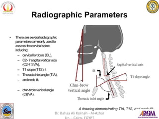 Radiographic Parameters
• There areseveralradiographic
parameterscommonlyusedto
assess thecervical spine,
including:
– cervical lordosis (CL),
– C2- 7sagittalvertical axis
(C2-7 SVA),
– T1 slope(T1S), t
– Thoracicinletangle (TIA),
– andneck tilt.
– chin-browverticalangle
(CBVA),
A drawing demonstrating TIA, T1S, and neck tilt.
Dr. Bahaa Ali Kornah - Al-Azhar
 