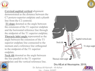 Cervical sagittal vertical alignment
demonstrated as the distance between the
C7 postero-superior endplate and a plumb
line from the C2 centroid.
T1 slope denoted as the angle between
the extension of the T1 superior endplate
and the horizontal reference line through
the midpoint of the T1 superior endplate.
Thoracic inlet angle represented as the
angle between the extension of the T1
superior endplate line connected to the
sternum and a reference line orthogonal
to the midpoint of the T1 superior
endplate.
Neck tilt denoted as the angle between
the line parallel to the T1 superior
endplate and the vertical reference line.
Dru AB,et al Neurospine. 2019;
Dr. Bahaa Ali Kornah - Al-Azhar
 