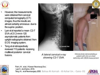 A lateral cervical x-ray
showing C2-7 SVA.
Clinical photo demonstrating a
patient with chin-on-chest
deformity with CBVAmeasurement
• However,themeasurements
wereobtainedfromcervical
computedtomography(CT)
images, thustheresultsare
almostcertainlyerroneous dueto
thesupine position.
• Lyer etal reporteda mean C2-7
SVA of21.3mmin120
asymptomaticpatientsfrom
uprightradiographsobtained from
EOS imagingsystem.
• Tang etal retrospectively
reviewed 113patients receiving
multilevel posterior cervical
fusions.
Park JH, etal J KoreanNeurosurgSoc.
LyerS. etal Spine. 2016.
T
angJA, etal Neurosurgery.2012
Dr. Bahaa Ali Kornah - Al-Azhar Un. - Cairo- EGYPT
 