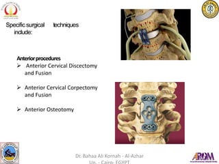 Specific surgical techniques
include:
Anteriorprocedures
 Anterior Cervical Discectomy
and Fusion
 Anterior Cervical Corpectomy
and Fusion
 Anterior Osteotomy
Dr. Bahaa Ali Kornah - Al-Azhar
 