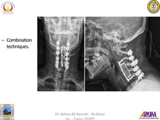 – Combination
techniques.
Dr. Bahaa Ali Kornah - Al-Azhar
 