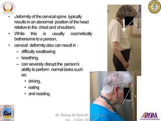 • Deformityof thecervical spine typically
results in an abnormal position of thehead
relative tothe chest and shoulders.
• While this is usually cosmetically
bothersometoa person,
• cervical deformityalso can resultin :
– difficulty swallowing
– breathing,
– can severely disruptthe person’s
ability toperform normaltasks such
as:
• driving,
• eating
• and reading.
Dr. Bahaa Ali Kornah - Al-Azhar
 