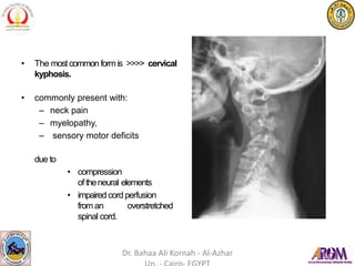 • The mostcommon form is >>>> cervical
kyphosis.
• commonly present with:
– neck pain
– myelopathy,
– sensory motor deficits
due to
• compression
oftheneural elements
• impaired cordperfusion
froman overstretched
spinal cord.
Dr. Bahaa Ali Kornah - Al-Azhar
 
