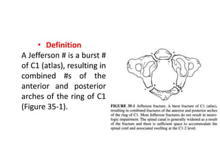 • Definition
A Jefferson # is a burst #
of C1 (atlas), resulting in
combined #s of the
anterior and posterior
arches of the ring of C1
(Figure 35-1).
 