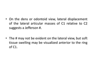 • On the dens or odontoid view, lateral displacement
of the lateral articular masses of C1 relative to C2
suggests a Jefferson #.
• The # may not be evident on the lateral view, but soft
tissue swelling may be visualized anterior to the ring
of C1.
 