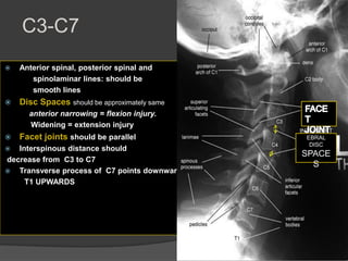 C3-C7


Anterior spinal, posterior spinal and
spinolaminar lines: should be
smooth lines



Disc Spaces should be approximately same
anterior narrowing = flexion injury.
Widening = extension injury



Facet joints should be parallel

Interspinous distance should
decrease from C3 to C7
 Transverse process of C7 points downward and
T1 UPWARDS


INTERVERT
EBRAL
DISC

SPACE
S

 