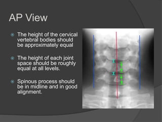 AP View


The height of the cervical
vertebral bodies should
be approximately equal



The height of each joint
space should be roughly
equal at all levels.



Spinous process should
be in midline and in good
alignment.

 