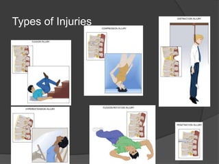 Types of Injuries

 