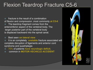 Flexion Teardrop Fracture C5-6
fracture is the result of a combination
of flexion and compression ,most commonly at C5-6
 The teardrop fragment comes from the
anteroinferior aspect of the vertebral body. The
larger posterior part of the vertebral body
is displaced backward into the spinal canal.


Best seen on lateral view
 It is an completely unstable fracture associated with
complete disruption of ligaments and anterior cord
syndrome and quadriplegia
 70% of patients have neurologic deficit.

common in MOTOR VECHICLE ACCIDENT


 