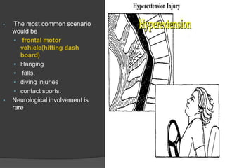 



The most common scenario
would be
 frontal motor
vehicle(hitting dash
board)
 Hanging
 falls,
 diving injuries
 contact sports.
Neurological involvement is
rare

 