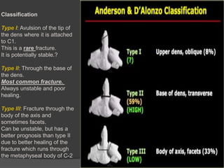 Classification

Type I: Avulsion of the tip of
the dens where it is attached
to C1.
This is a rare fracture.
It is potentially stable.?
Type II: Through the base of
the dens.
Most common fracture.
Always unstable and poor
healing.
Type III: Fracture through the
body of the axis and
sometimes facets.
Can be unstable, but has a
better prognosis than type II
due to better healing of the
fracture which runs through
the metaphyseal body of C-2

 