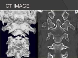 CT IMAGE

 