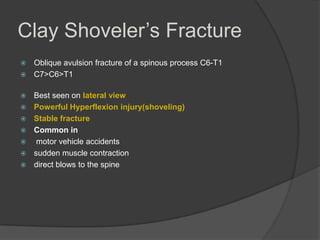 Clay Shoveler’s Fracture
Oblique avulsion fracture of a spinous process C6-T1
 C7>C6>T1










Best seen on lateral view
Powerful Hyperflexion injury(shoveling)
Stable fracture
Common in
motor vehicle accidents
sudden muscle contraction
direct blows to the spine

 