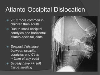 Atlanto-Occipital Dislocation







2.5 x more common in
children than adults
Due to small occipital
condyles and horizontal
atlanto-occipital joints
Suspect if distance
between occipital
condyles and C1 is
> 5mm at any point
Usually have ++ soft
tissue swelling

 