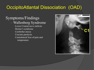 OccipitoAtlantal Dissociation (OAD)
Symptoms/Findings
– Wallenberg Syndrome
Lower Cranial nerve deficits
Horner’s syndrome
Cerebellar ataxia
Cruciate paralysis
Contralateral loss of pain and
temperature

 