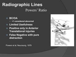 Radiographic Lines
Powers’ Ratio


BC/OA
 >1 considered abnormal





Limited Usefulness
Positive only in Anterior
Translational injuries
False Negative with pure
distraction

Powers et al, Neurosurg, 1979

 