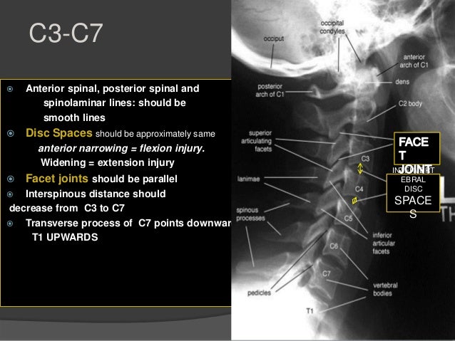 Cervical spine fractures muhamma