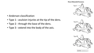 Cervical spine injuries.pptx