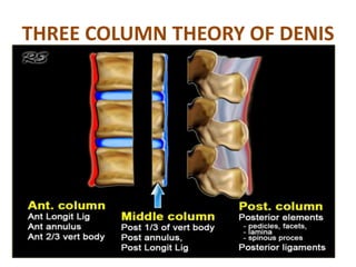 THREE COLUMN THEORY OF DENIS
 