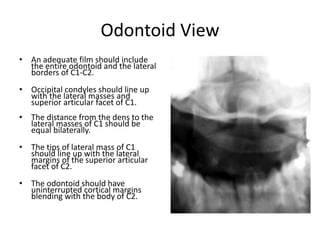 Odontoid View
• An adequate film should include
the entire odontoid and the lateral
borders of C1-C2.
• Occipital condyles should line up
with the lateral masses and
superior articular facet of C1.
• The distance from the dens to the
lateral masses of C1 should be
equal bilaterally.
• The tips of lateral mass of C1
should line up with the lateral
margins of the superior articular
facet of C2.
• The odontoid should have
uninterrupted cortical margins
blending with the body of C2.
 