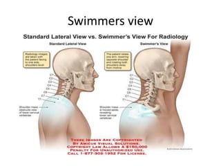 Swimmers view
 